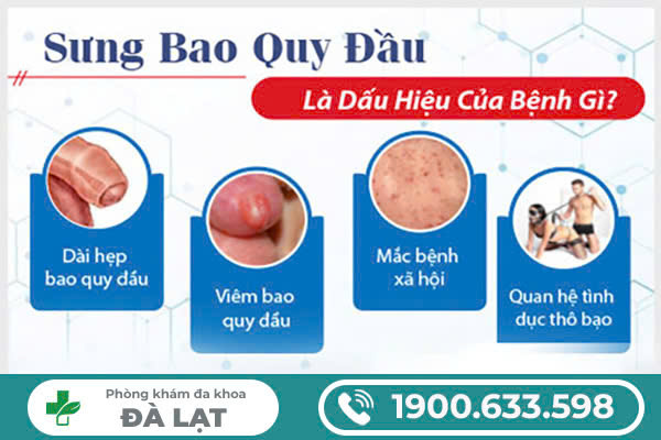 Hình ảnh minh họa